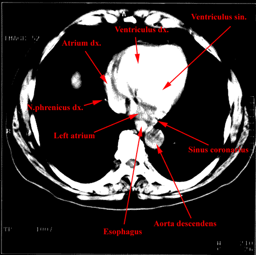 anatomia radiologiczna - 14.gif