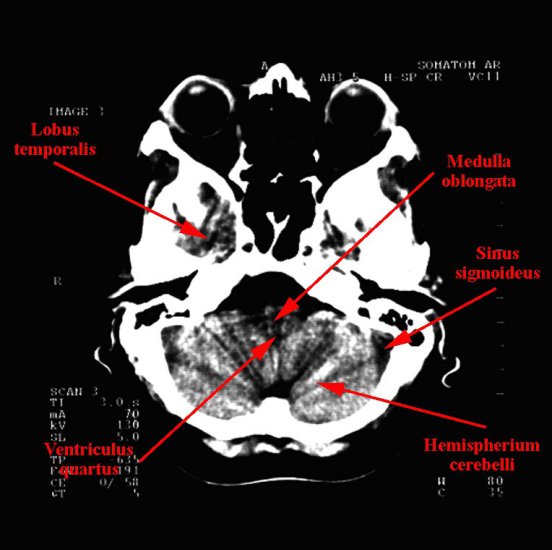anatomia radiologiczna - 02b.jpg