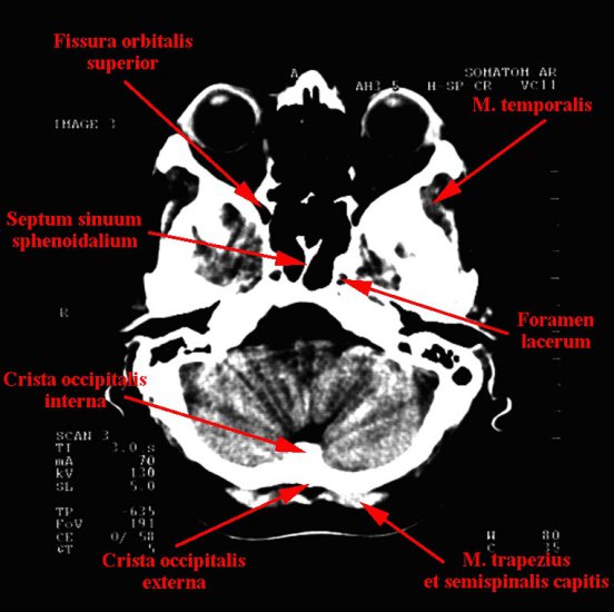 anatomia radiologiczna - 02a.jpg