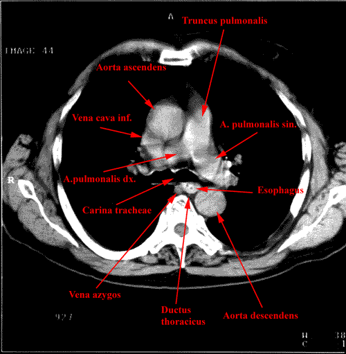 anatomia radiologiczna - 91.gif
